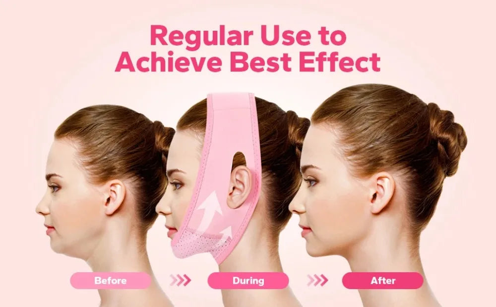 V-Line Face Lifting Strap – Slim, Lift & Define Your Look