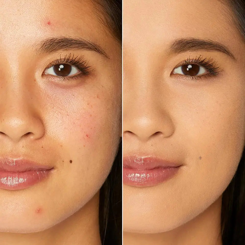 10ml Concealer – Covers Dark Circles & Acne Scars, Moisturizing & Lightweight