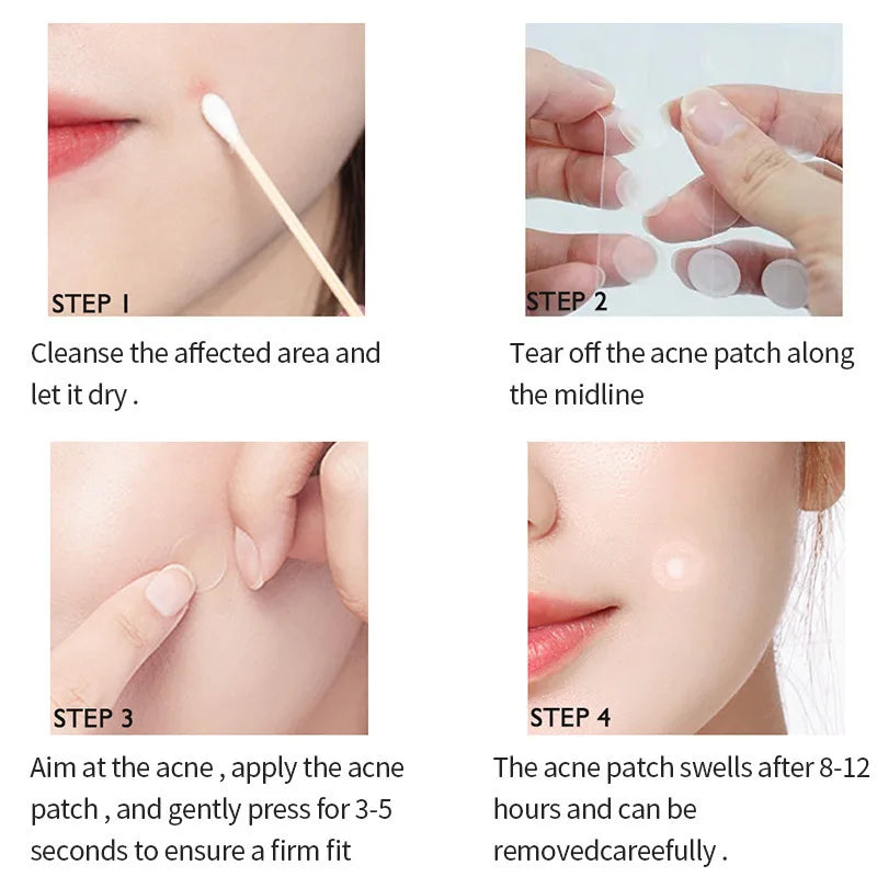 72–720PCS Invisible Acne Patches – Waterproof Hydrocolloid Pimple & Blemish Repair Stickers