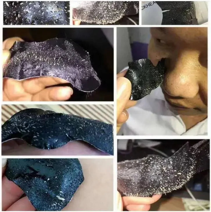 0PCS Bamboo Charcoal Blackhead Remover Nose Mask – Deep Cleansing Pore Strips