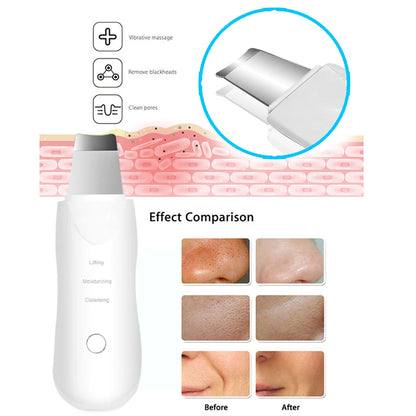 Ultrasonic Skin Scrubber – Deep Facial Cleanser & Blackhead Remover