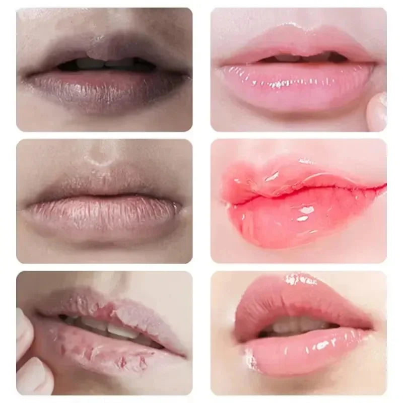 Moisturizing Lip Balm – Exfoliate, Brighten & Nourish Lips