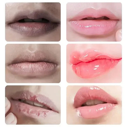 Moisturizing Lip Balm – Exfoliate, Brighten & Nourish Lips