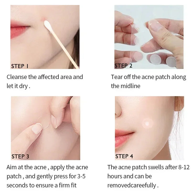 72–720PCS Invisible Acne Patches – Waterproof Hydrocolloid Pimple & Blemish Repair Stickers