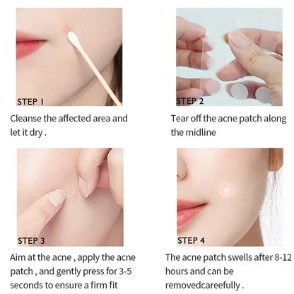 72–720PCS Invisible Acne Patches – Waterproof Hydrocolloid Pimple & Blemish Repair Stickers