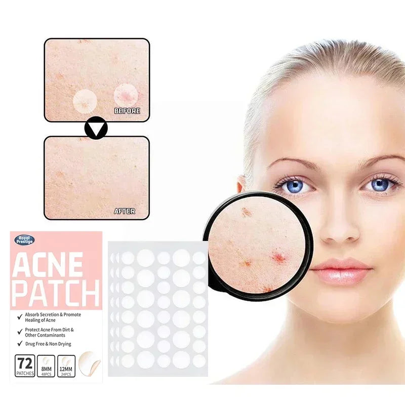 72–720PCS Invisible Acne Patches – Waterproof Hydrocolloid Pimple & Blemish Repair Stickers