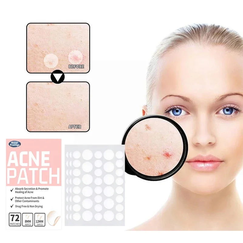 72–720PCS Invisible Acne Patches – Waterproof Hydrocolloid Pimple & Blemish Repair Stickers